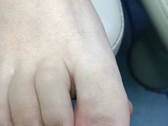-新甲连锁灰指甲·甲沟炎·鸡眼(黑龙江路店)