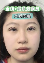 -上海伊莱美医疗美容医院