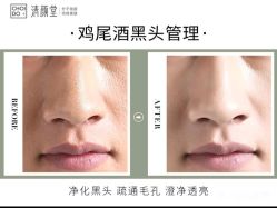 -清颜堂丨分子祛痘·功效美肤