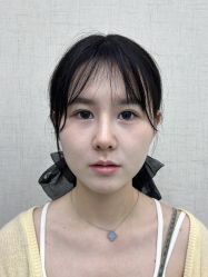 体验前-深圳艺星医疗美容医院