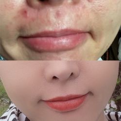 -JUVA欧华医美连锁