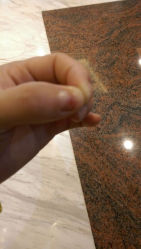 android_upload_pic-EPAI·灰指甲·甲沟炎·嵌甲护理