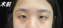 -素美医疗美容·西南眼鼻整形·修复基地