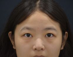 -成都西区医院整形美容