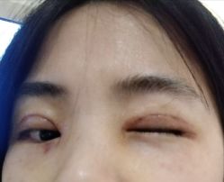-深圳阳光医疗美容医院·旗舰店