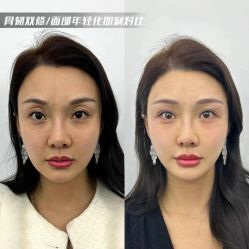 -Yestar 嘉兴艺星医疗美容医院