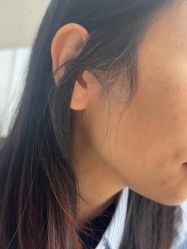 -广州美莱医疗美容医院