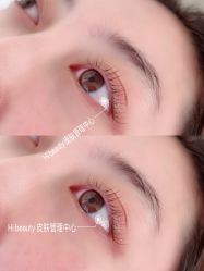 -Hi Beauty Skin 科技美肤中心