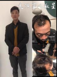 -唐风采假发补发定制