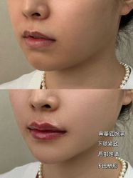 -素美医疗美容·西南眼鼻整形·修复基地