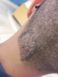 -雍禾植发全国连锁