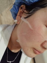 -四川米兰柏羽医学美容医院