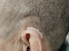 -安湃声助听器(密云店)
