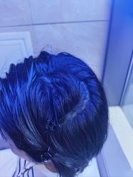 -碧莲盛·不剃发植发