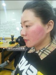 -AiCure 埃可儿·韩国医学皮肤管理