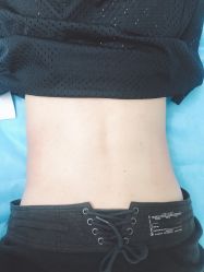 -CMS西美斯·美式医疗美容