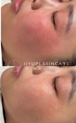 点击看大图 -MLP美丽派·问题肌疗愈中心