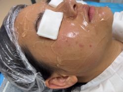 -长沙雅美医疗美容医院