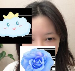 -大麦微针植发丨全国连锁