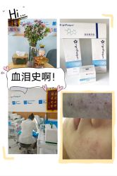 -靓芙泉专研痘痘肌