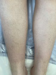 -中科妍美专业脱毛美肤连锁机构