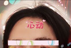 -大麦微针植发全国连锁