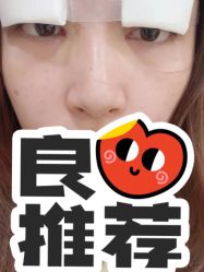 -万州华美紫馨整形美容医院