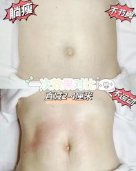 -Lily纤美·科技减脂中心