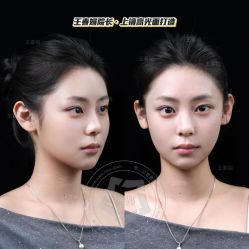 -Yestar艺星医疗美容医院