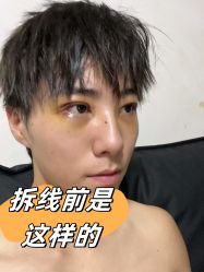 -素美医疗美容·西南眼鼻整形·修复基地