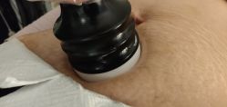 -肥三针腧穴瘦身馆