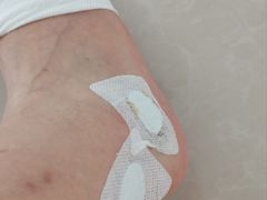 -武汉大学人民医院(首义院区)