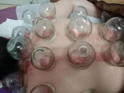-余祖萍专业经络瘦身