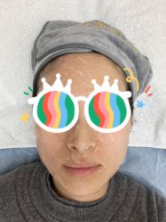 体验后-JS医疗美容