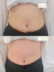 -摩瘦纤体订制减肥