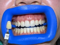 -极光口腔·矫正种植修复(锦江院区)