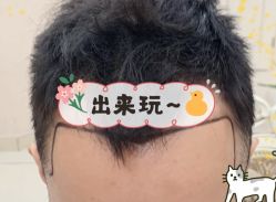 -大麦微针植发全国连锁