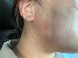 -清华大学玉泉医院-医疗美容科