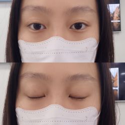 -天津健丽·去眼袋医疗美容机构