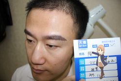 -大麦微针植发丨全国连锁