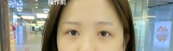 -MISS STAR·半永久纹眉·发际线·美瞳线