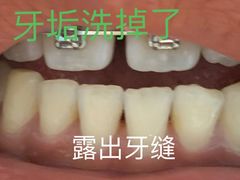 -爱齿尔口腔医院(中南院)
