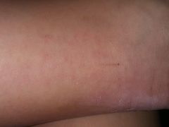 -杭州市第三人民医院