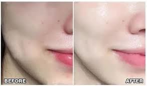 -SKINIST丽铂医疗美容