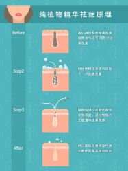 -清疣美疣·痣·斑净肤中心