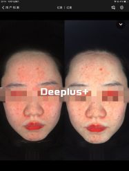 -Deeplus+韩国皮肤管理한국피부관리·C:Lab肌肤实验室