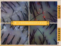 -顶尚堂白发脱发养发