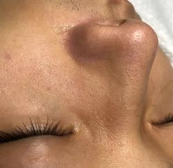 -苑苑vbeauty科技美容SPA