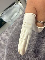 -北京豆豆博士专业祛痘