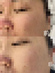 -skin79皮肤管理中心